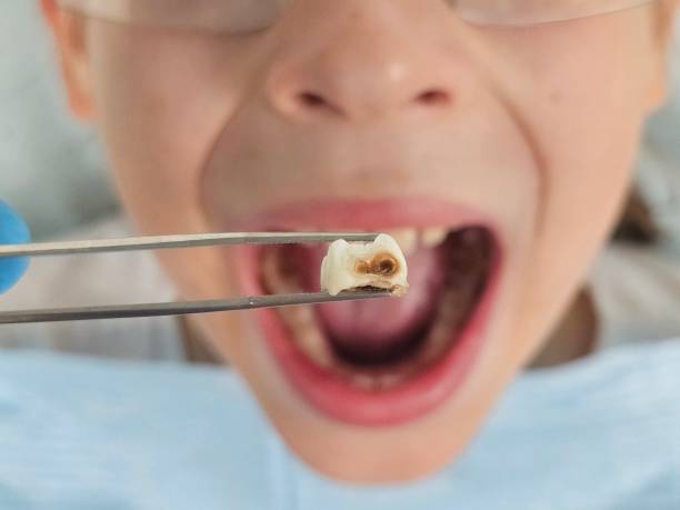 Best Mobile Emergency Dentist in Bayboro, NC
